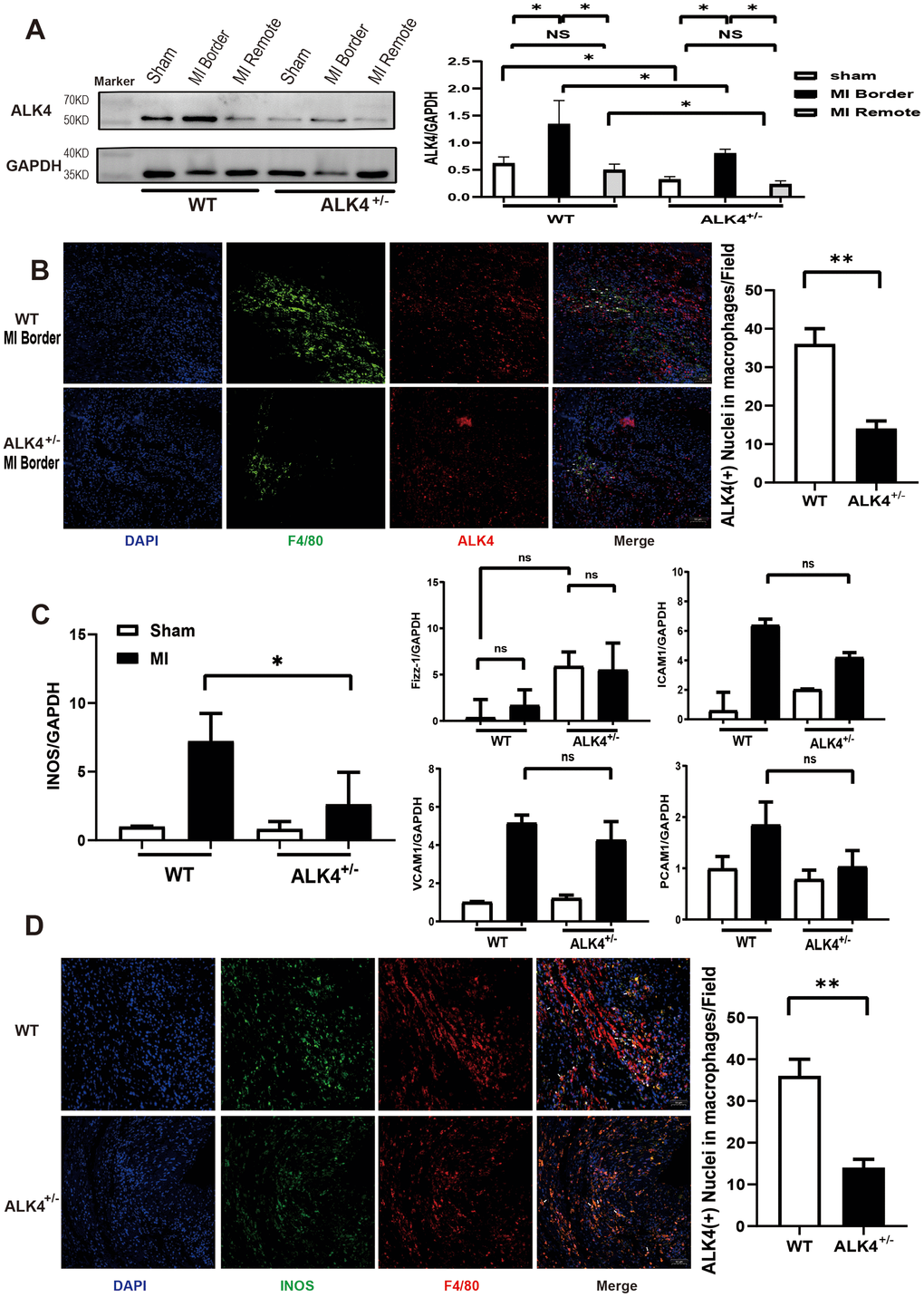 ALK4 haplodeficency reduces cardiac inflammation after myocardial injury. (A) ALK4 protein expression in WT and ALK4+/- mice in 4 groups (n=4 for each). (B) ALK4 protein expression in macrophages in WT and ALK4+/- mice on the 3rd day post-MI (n=5). (C) The mRNA expression of iNOS, Fizz-1, ICAM1, VCAM1 and PECAM1 were showed. (D) INOS expression in WT and ALK4+/- mice on the 3rd day post-MI (n=5). *P 