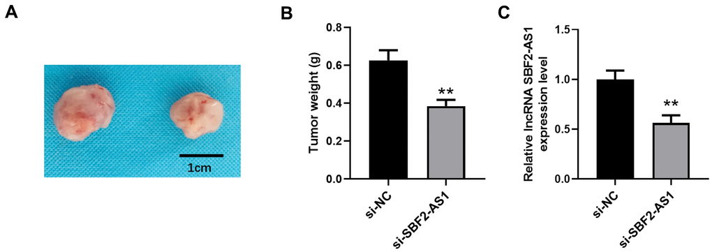Downregulation of lncRNA SBF2-AS1 inhibits HCC growth in an XMM. (A) Representative tumor images. (B) Statistical results surrounding tumor volume. (C) The level of lncRNA SBF2-AS1 in HCC tissues. The obtained data are expressed as mean ± SEM. ** P 