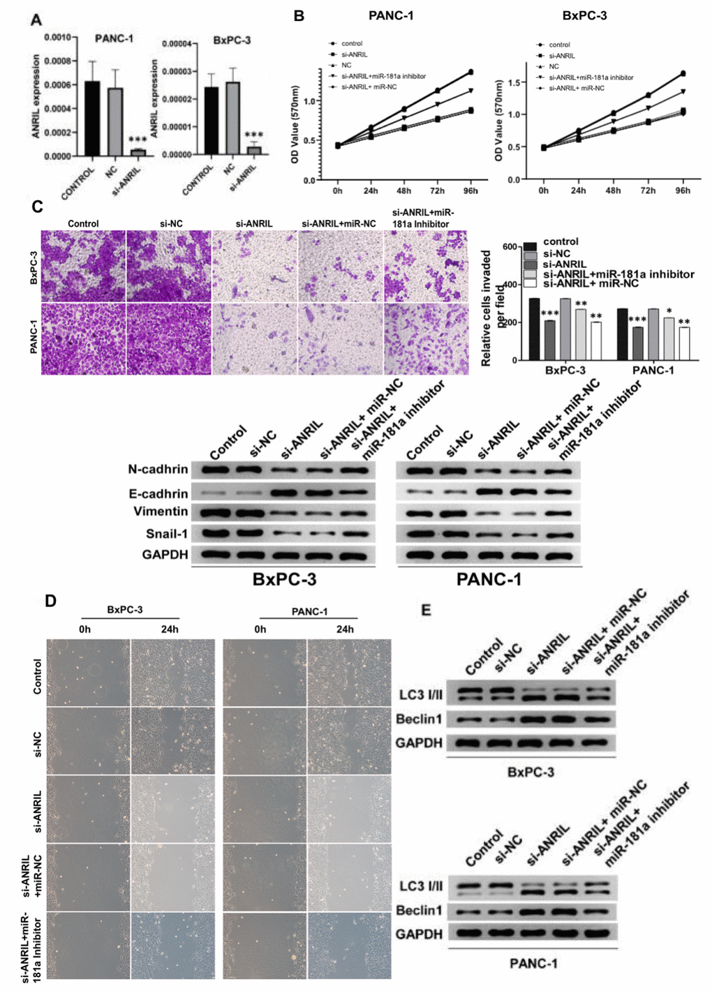 Knockdown of ANRIL inhibits the progression of pancreatic cancer. (A) Knockdown of ANRIL effectively inhibited ANRIL expression in PANC-1 cells and BxPC-3 cells. (B) MTT assay showed that the proliferation effect of pancreatic cancer cells transfected with si-ANRIL was significantly lower than that of the control group, while miR-181a inhibitor reversed the effect of si-ANRIL on pancreatic cancer cells. (C) Top: The transwell experiment reflected the effects of si-ANRIL and miR-181a inhibitor on the invasion ability of PANC-1 cells and BxPC-3 cells. Bottom: Western blot analyzed the expression levels of N-cadherin, E-cadherin, Vimentin, and Snail-1, they also represented the invasion ability of PANC-1 cells and BxPC-3 cells. (D) Scratch experiments revealed changes in healing ability of PANC-1 cells and BxPC-3 cells transfected with si-ANRIL, si-ANRIL+ miR-NC, si-ANRIL+miR-181a inhibitor, respectively. (E) The expression levels of LC3 I/II and Beclin1 reflected the regulation of autophagy levels of PANC-1 cells and BxPC-3 cells by si-ANRIL and miR-181a inhibitor. Standardized data with GAPDH. *P **P ***P 