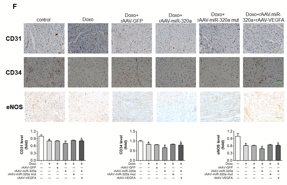 Restored VEGF‐A eliminated the miR‐320a induced cardiac dysfunction in doxorubicin treated mice. (F) Expression level of CD31, CD34 and eNOS in heart detected by immunohistochemical staining. Scale bar, 200μm. Data are expressed as mean ± SEM, n≥4, *P