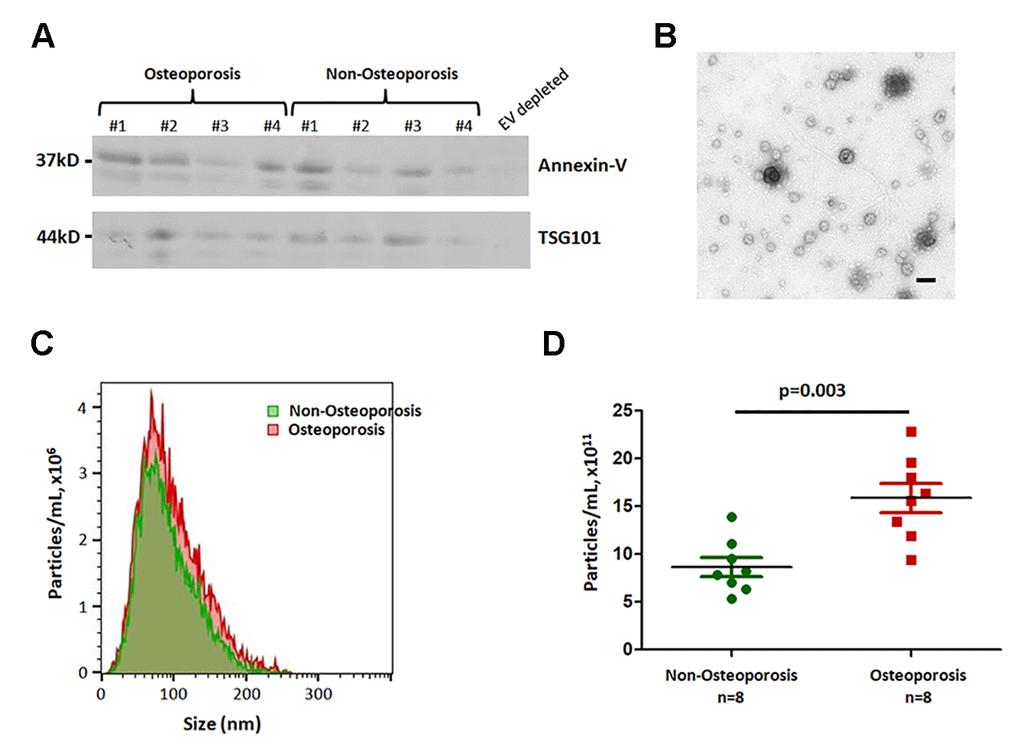 Characterization and concentration analysis of extracellular vesicles. (A) Plasma-derived EVs isolated from four individuals with osteoporosis, four individuals without osteoporosis, one EV-depleted plasma sample were subjected to SDS-PAGE and probed for EV-enriched proteins, Annexin-V and TSG101. (B) Electron microscopy of EVs. Scale bar = 500 nm. (C) and (D) Nanoparticle tracking analysis (NTA). The area under the curve in (C) is shown in (D).
