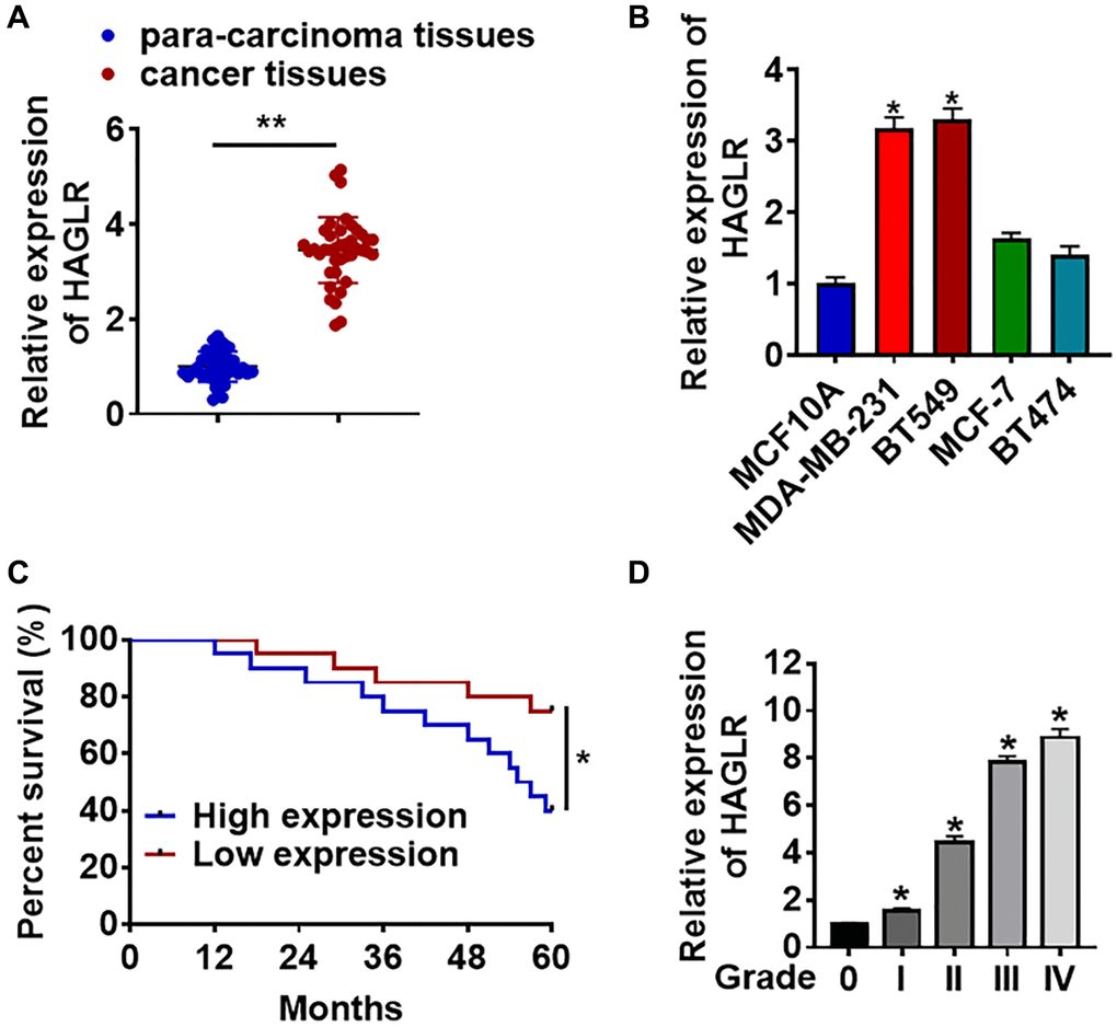 The expression of lncRNA HAGLR in TNBC tissues and cells. We collected 40 samples of patients diagnosed with TNBC. (A) The expression of HAGLR in para-carcinoma and cancer tissues was detected by qRT-PCR. (B) qRT-PCR analysis for HAGLR level in normal breast cell MCF10A and TNBC cell lines MDA-MB-231 and BT549. (C) According to the mean level of HAGLR in Figure 1A, 40 TNBC patients was divided into low (n = 20) and high expression group (n = 20). Kaplan-Meier curves indicated 5-year survival rate of TNBC patients. (D) Another 40 TNBC patients were collected, which includes grade 0 to grade IV of TNBC (n = 8 for each grade), and qRT-PCR was used to test HAGLR level in different grades. Data are mean ± SD; *P **P 