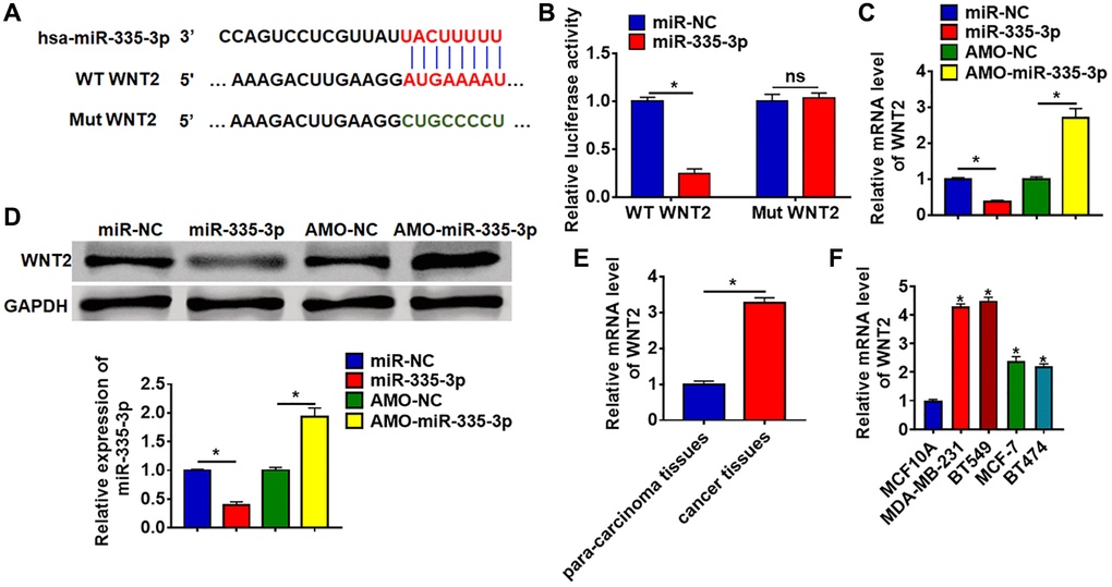 WNT2 was a directed target of miR-335-3p. (A) The binding bases of miR-335-3p and WNT2 from Targetscan. (B) Wild type and mutant WNT2 was transfected into HEK293 cells with or without miR-335-3p, and luciferase assay was to evaluate the binding. BT549 cells were transfected with miR-335-3p or AMO-miR-335-3p, (C) the mRNA level and (D) the protein level of WNT2 was detected. (E–F) The expression of WNT2 in TNBC tissues and cells was determined by qRT-PCR. Data are mean ± SD; *P 