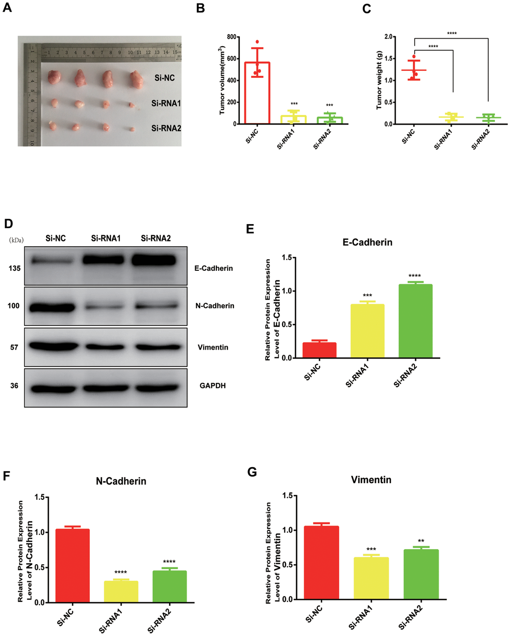 NUDCD1 knockdown inhibited the growth of PC in vivo. (A–C) NUDCD1 knockdown remarkably reduced tumor volume and weight. (D–G) NUDCD1 knockdown decreased the expression of N-cadherin and vimentin and increased the expression of E-cadherin in tumor tissue. **p