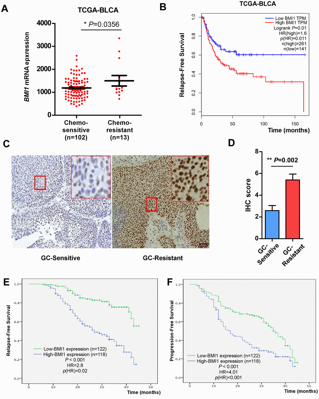 Elevated BMI1 in GC-chemoresistant bladder cancer conferred poor prognosis. (A) BMI1 mRNA expression in bladder cancer tissues of patients partial response to chemotherapy versus patients complete response to chemotherapy from TCGA-BLCA database. (B) Relapse-free survival of patients in TCGA-BLCA dataset with low versus high levels of BMI1 mRNA. (C) IHC analysis of BMI1 protein expression in bladder cancer tissues of patients resistant to GC chemotherapy and that sensitive to GC chemotherapy, magnification, ×200 & ×400. (D) Statistical quantification of the IHC score of BMI1 staining in bladder cancer specimens from patients resistant versus sensitive to GC chemotherapy. (E) Relapse-free survival of patients with bladder cancer with low versus high BMI1 expression. (F) Progression-free survival of patients with bladder cancer with low versus high BMI1 expression. *P 