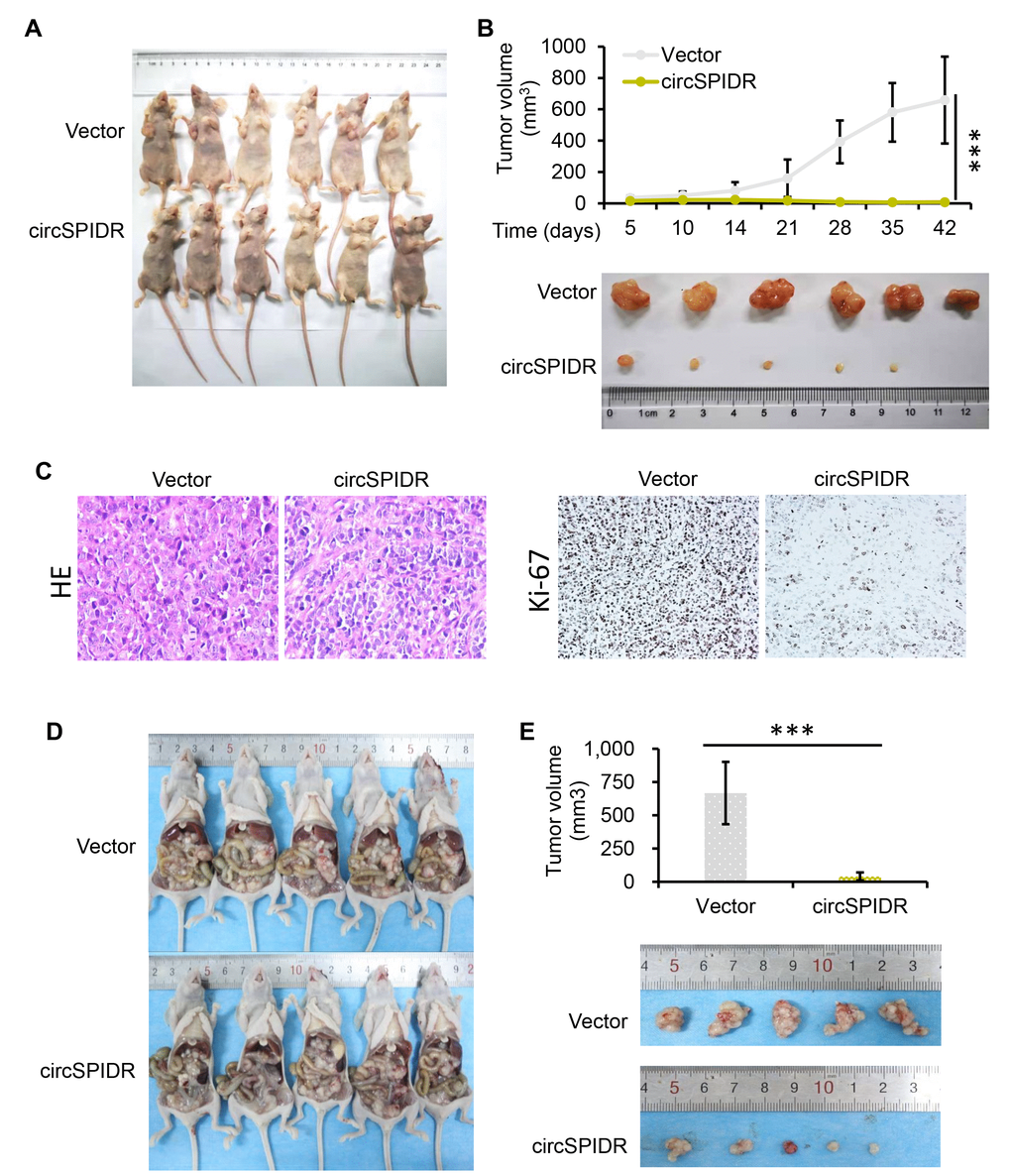 CircSPIDR overexpression inhibits HeLa cell growth in vivo. (A) HeLa cells expressing circSPIDR or the vector control were inoculated into BALB/c nude mice (n = 6/group) to establish subcutaneous xenograft tumors. Representative images of nude mice bearing CADC tumors are shown. (B) Growth curves and representative images of isolated xenograft tumours. The volume of the local tumors was measured. (C) Hematoxylin and eosin staining was performed and Ki-67 protein expression was evaluated in the xenograft tumors. (D, E) Representative images of nude mice intraperitoneally transplanted with HeLa/circSPIDR and HeLa/vector cells. ***P 