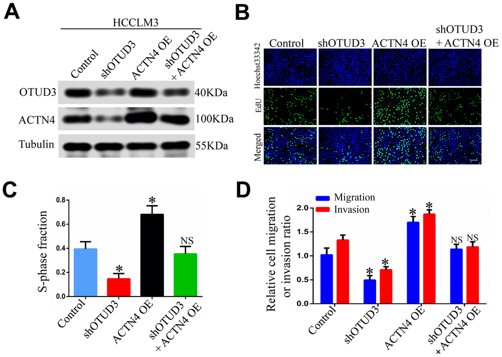 ACTN4 is critical for OTUD3-mediated HCC cells progression in vitro and in vivo. (A) Western blot confirming the downregulation of OTUD3 abated increased ACTN4 expression in HCCLM3 cells. (B, C) EdU assay evaluating the effect of OTUD3 knockdown on accelerated HCC cell growth enhanced by ACTN4 upregulation. (D) Quantification of HCC cell transwell migration and invasion results.