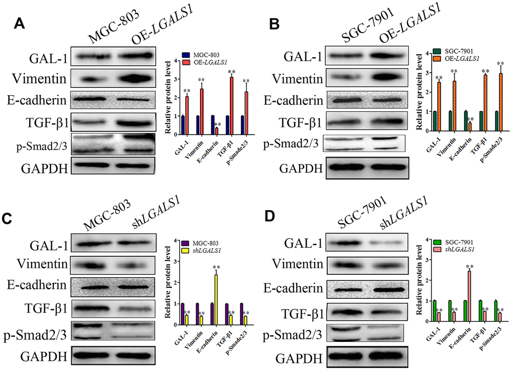 GAL-1/ LGALS1 induces EMT through TGF-β/Smad signaling pathways in vitro. (A, B) WB showing that OE-LGALS1 efficiently increased the expression of TGF-β1 and p-Smad2/3 and induced EMT in MGC-803 and SGC-7901 cells compared with the wild-type cells (all P C, D) Silencing LGALS1 in MGC-803 and SGA-7901 cells efficiently decreased the levels of TGF-β1 and p-Smad2/3 and inhibited EMT (all P 
