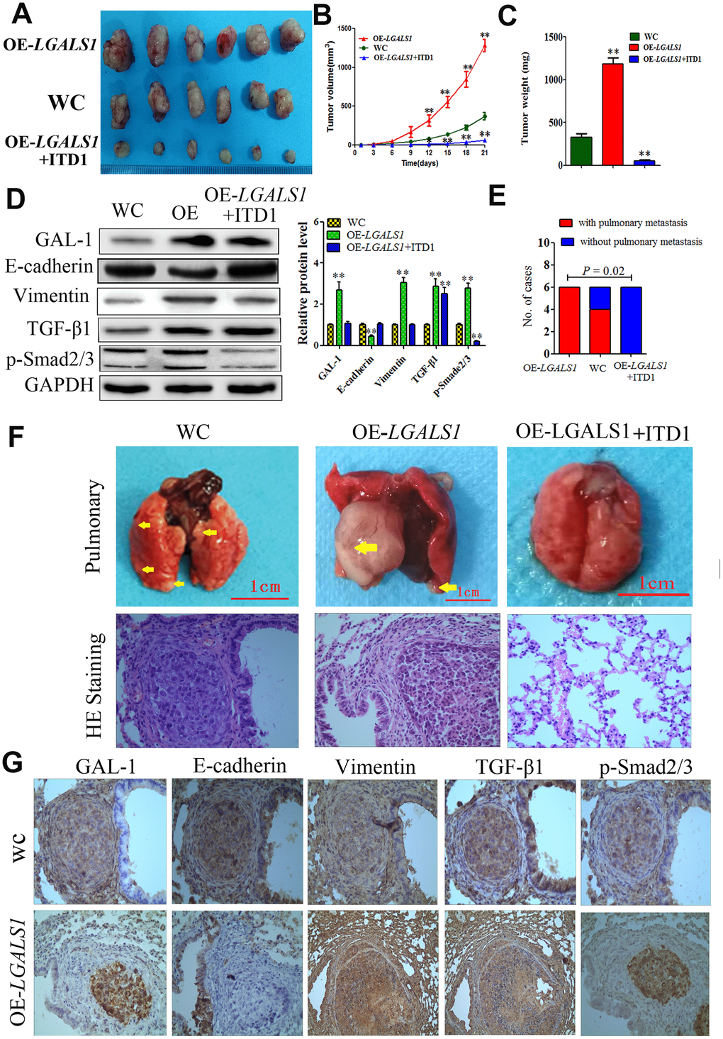 GAL-1/ LGALS1 promotes GC cell metastasis in vivo through the TGF-β/Smad signaling pathway. (A) OE-LGALS1 induced MGC-803 to form subcutaneous xenograft tumors with larger volumes (B) and weighs (C) (expressed as the mean ± SE). * P PD) OE-LGALS1 increased the levels of TGF-β1 and p-Smad2/3, and induced EMT in the subcutaneous xenograft tumor, ITD1 could inhibit this effect. Metastases were frequent in the (E). (F) Representative images of metastasis (yellow arrows) in the lungs at 50 days after inoculation, and representative images of H&E staining. Original magnification: ×400. (G) Immunostaining showing GAL-1, E-cadherin, vimentin, TGF-β1 and p-Smad2/3 levels in pulmonary metastases. Magnification: ×400.