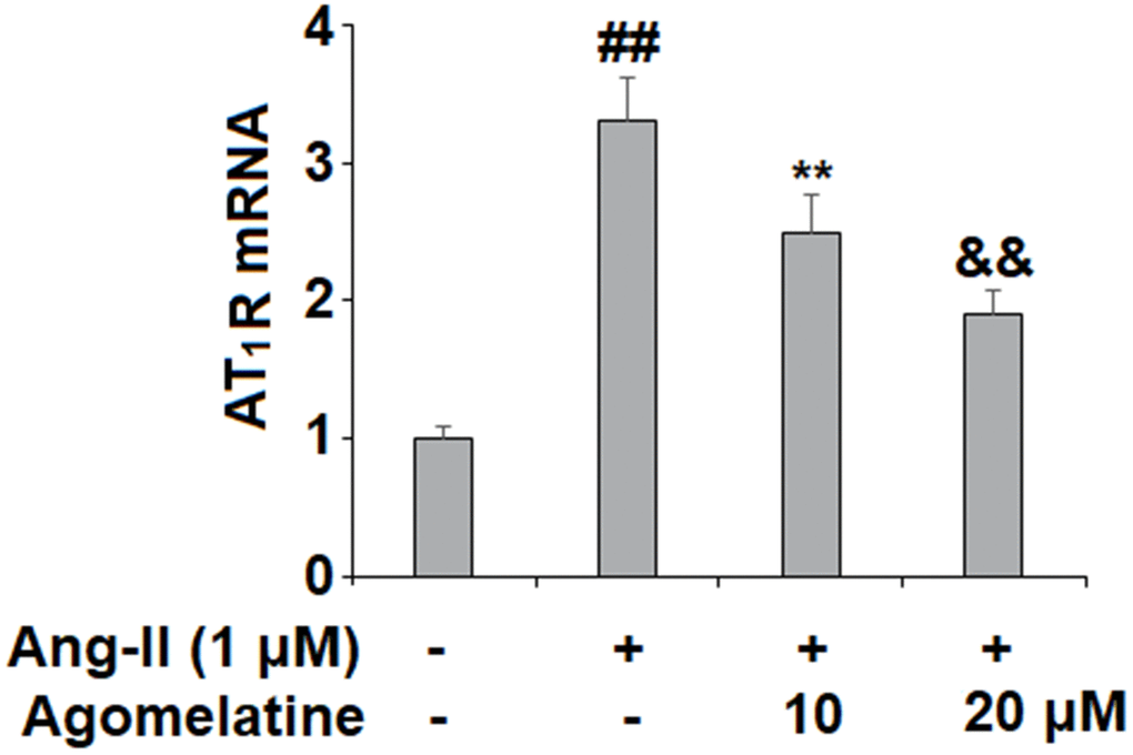 Agomelatine reduced Ang II-induced the expression of Ang II type 1 receptor (AT1 receptor) in HUVECs. HUVECs were treated with Ang II (1 μM) with or without agomelatine (10, 20 μM) for 24 h. mRNA of AT1 receptor (##, **, &&, P