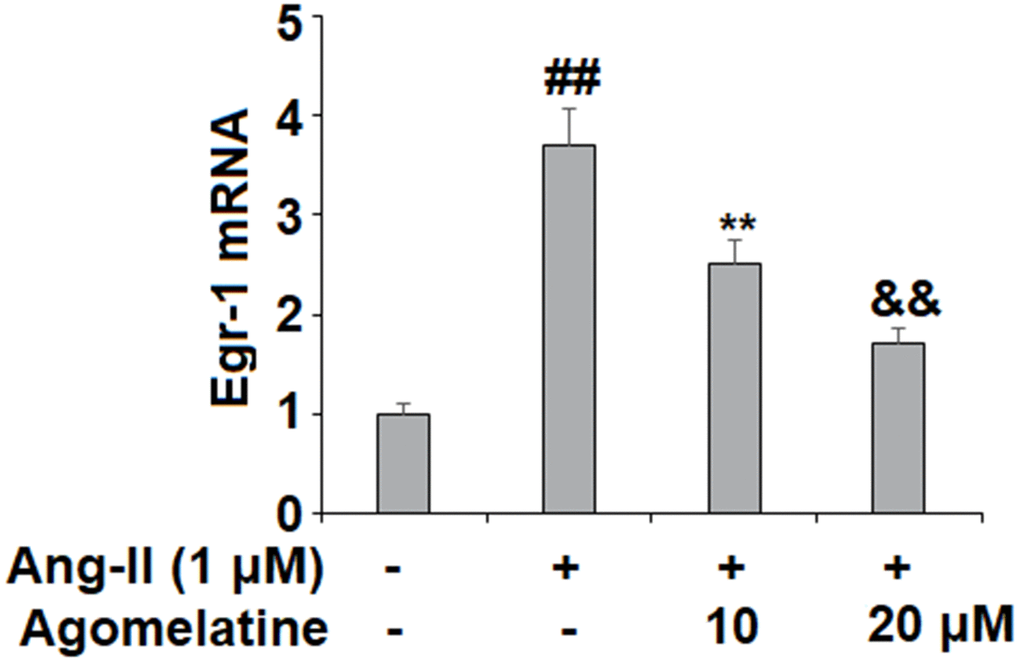Agomelatine reduced Ang II-induced expression of Egr-1 in HUVECs. HUVECs were treated with Ang II (1 μM) with or without agomelatine (10, 20 μM) for 24 h. mRNA of Egr-1 (##, **, &&, P
