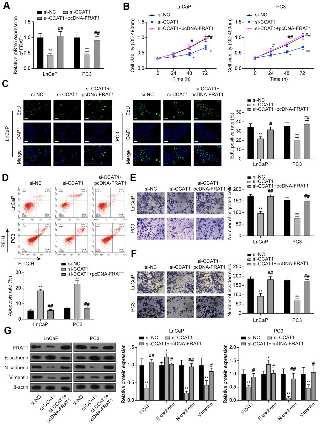 FRAT1 overexpression reversed the effects of CCAT1 suppression in PCa cells. (A) mRNA expression of FRAT1 in LnCaP and PC3 cells transfected with si-CCAT1 or si-CCAT1+pcDNA-FRAT1. (B) The results of MTT assays indicated that down-regulation of CCAT1 suppressed cell viability, and the suppressed ability was counteracted by pcDNA-FRAT1. (C) EdU staining results of LnCaP cells and PC3 cells treated with si-CCAT1 or si-CCAT1+pcDNA-FRAT1. Scale bar: 50 μm. (D) Flow cytometry detection of the cell apoptosis changes in LnCaP cells and PC3 cells treated with si-CCAT1 or si-CCAT1+pcDNA-FRAT1. (E, F) Cell migration and invasion were reduced with si-CCAT1 transfection, and recovered by overexpressing FRAT1. (G) Protein expression of FRAT1, E-cadherin, N-cadherin, and Vimentin in PCa cells were detected by western blot. *P P P P 