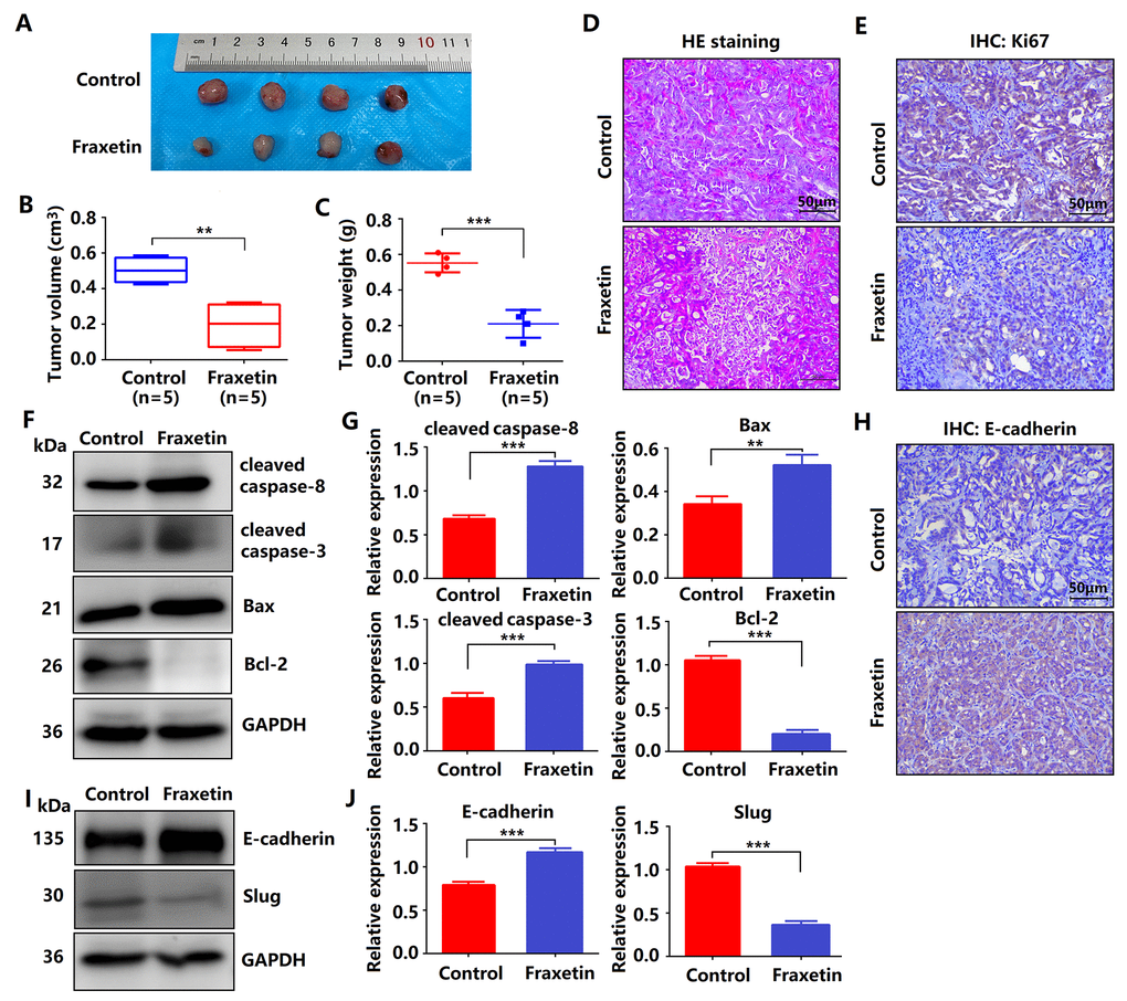 Fraxetin inhibits tumor growth and metastasis of PDA in animal xenograft models. (A) Effects of fraxetin on experimental groups’ morphologic changes. (B) Effect of fraxetin on the volume of tumors in animal xenograft models. (C) Effects of fraxetin on tumor weight. (D) PDA pathological results in tissues of the model group stained with HE. Bar = 50 μm. (E) Immunohistochemical (IHC) staining for Ki67 in fraxetin-treated models. Bar = 50 μm. (F, G) Western blot analysis of cleaved caspase-8, cleaved caspase-3, Bax, and Bcl-2 expression in PANC-1 and Patu8988 cells treated with or without fraxetin. (H) IHC staining for E-cadherin in fraxetin-treated models. Bar = 50 μm. (I, J) Western blot analysis of E-cadherin and Slug expression in PANC-1 and Patu8988 cells treated with or without fraxetin. Data were presented as the mean ± standard deviation, and were analyzed by a two-sided Student’s t-test. *P **P ***P 