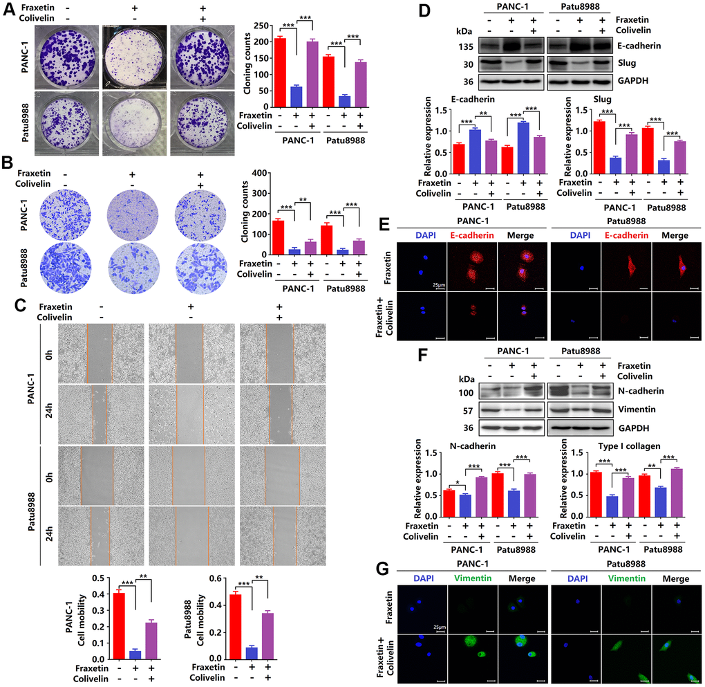 Reactivation of STAT3 reverses the anti-tumor effects of fraxetin. (A) The proliferation of fraxetin-treated PANC-1 and Patu8988 cells with or without colivelin treatment was analyzed by colony formation assay. (B) The transwell chamber assay analyzed the invasion ability of fraxetin-treated PANC-1 and Patu8988 cells with or without colivelin treatment. (C) A wound healing assay was used to determine the migration ability of fraxetin-treated PANC-1 and Patu8988 cells with or without colivelin treatment. (D) E-cadherin and Slug expression in fraxetin-treated PANC-1 and Patu8988 cells with and without colivelin treatment, as determined by Western blot analysis. (E) Immunocytochemical staining of E-cadherin in fraxetin-treated PANC-1 and Patu8988 cells with or without colivelin treatment. Bar = 25 μm. (F) N-cadherin and Type I collagen expression in fraxetin-treated PANC-1 and Patu8988 cells with and without colivelin treatment, as determined by Western blot analysis. (G) Immunocytochemical staining of vimentin in fraxetin-treated PANC-1 and Patu8988 cells with or without colivelin treatment. Bar = 25 μm. Data were presented as the mean ± standard deviation, and were analyzed by One-way ANOVA with Bonferroni’s post-hoc test and two-sided Student’s t-test. *P **P ***P 