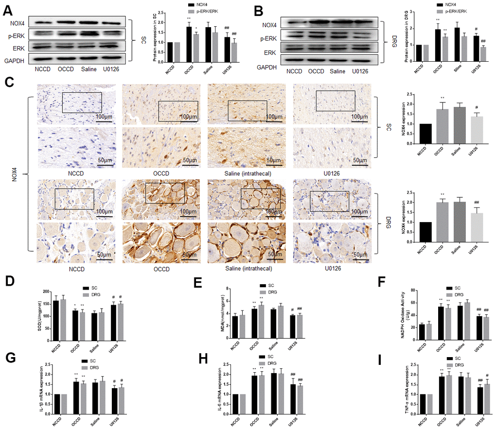 ERK phosphorylation, NOX4 expression, oxidative stress and inflammation are elevated in the L4, L5 spinal cord and DRG of obese CCD rats, which are abolished by an ERK inhibitor. (A–C) The protein levels of p-ERK, ERK, and NOX4 in nervous tissue of rats were determined by western blot and immunohistochemistry. (D–F) SOD, MDA, NADPH oxidase activity in nervous tissue were detected by kit. (G–I) IL-1β, IL-6, and TNF-α mRNA levels in nervous tissue were detected by PCR. N = 10-15 per group, *P P #P ##P 