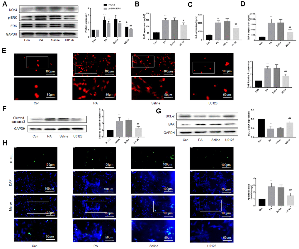 An ERK inhibitor improves NOX4 expression, inflammation, oxidative stress and apoptotic level of DRG neurons cultured in PA-added medium in vitro. PA was applied to simulate a high-fat environment and U0126 to inhibit ERK. (A) The expression of p-ERK, ERK, and NOX4 in DRG neurons were detected by western blot. (B–D) The supernatant of cultured cells was collected and the secretion of IL-1β, IL-6, and TNF-α was determined by ELISA. (E) The ROS content was detected by oxidant-sensitive fluorescence probe DHE. (F, G) The expression of cleaved caspase3, bcl-2 and bax in DRG neurons were detected by western blot. (H) Cell apoptosis level was detected by TUNEL method. N = 5 per group, **P P P 