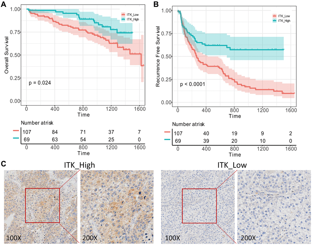 Validation of ITK’s prognostic capacity. 176 pairs of HCC tumor and paracarcinoma tissues were obtained from our medical center and ITK expression levels were evaluated using IHC analysis. (A) KM survival curves for the post-operation OS of low/high ITK subgroups (p = 0.024). (B) KM survival curves for the post-operation RFS of low/high ITK subgroups (p C) IHC of ITK expression.