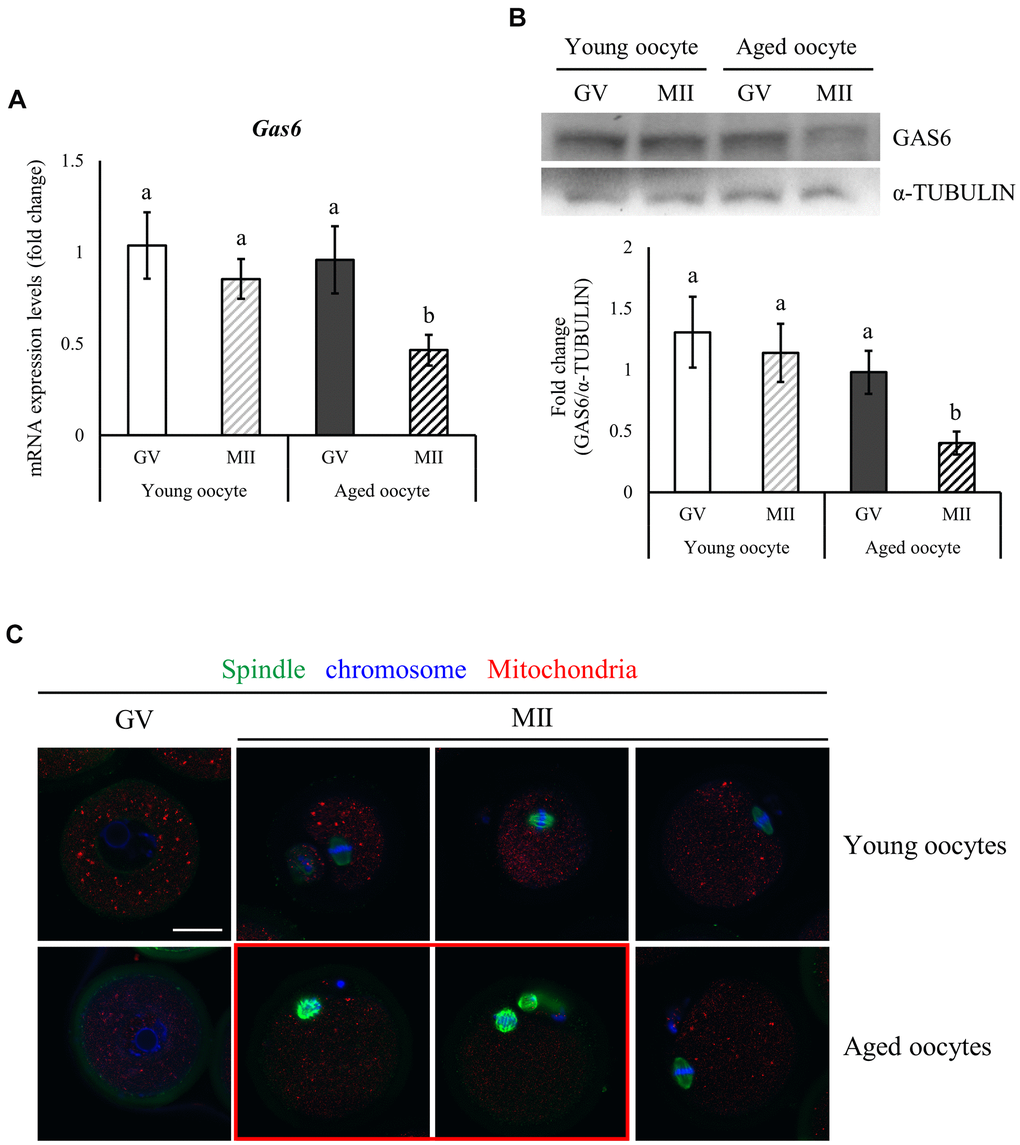 Reduced expression of Gas6 and increased meiotic errors in oocytes with maternal aging. (A, B) Typical expression patterns of the Gas6 transcripts (A) and protein (B) in GV and MII oocytes from young and aged female mice, respectively. Gas6 expression was significantly decreased in aged oocytes. The levels of the GAS6 protein are presented in a bar graph. The data are presented as the means ± SEM. Different letters indicate significant differences at pC) Maternal aging causes spindle organization defects and chromosome misalignment during oocyte maturation. Green, spindle; blue, chromosome; red, mitochondria; red box, oocyte with abnormal spindle and chromosome alignment. The scale bars represent 25 μm.