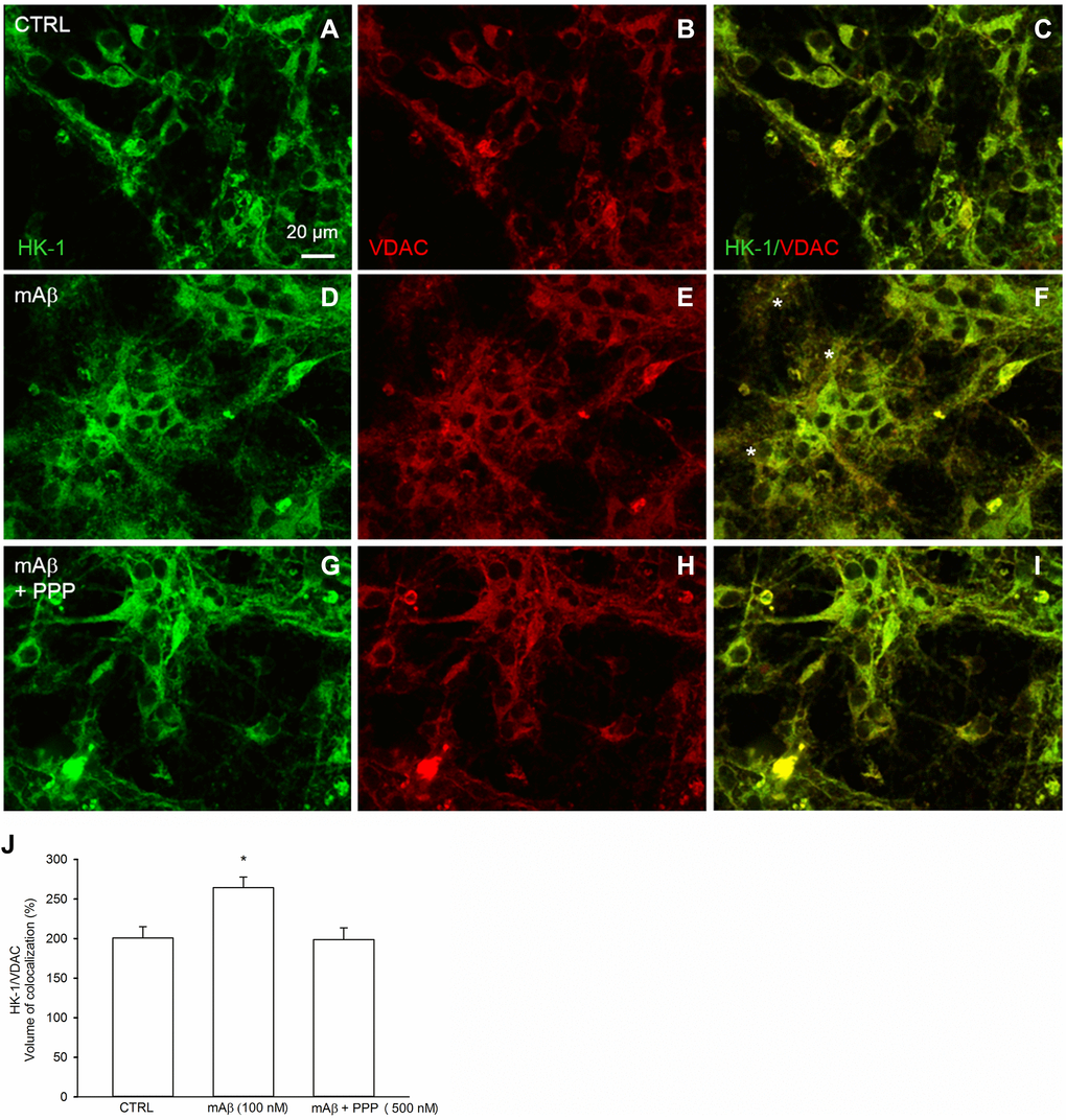 Synthetic Aβ42 monomers increased the mitochondrial localization of HK-1 at the neurite processes in a manner dependent on IGF-IR activation. Confocal images of primary cortical neurons glucose-starved for 2 hours before returning to 3 mM glucose, in the absence (CTRL, A–C) or in the presence of either 100 nM synthetic Aβ42 monomers for 40 min (mAβ, D–F) or synthetic Aβ42 monomers + 500 nM PPP (mAβ + PPP, G–I). Neurons were immunostained for HK-1 (green fluorescence) and VDAC (red fluorescence). Overlays of green and red fluorescence for each experimental conditions are shown on the right side of the figure (C, F, I). In (F) asterisks indicate neurite processes exhibiting green (HK-1)/red (VDAC) co-localization (orange to yellow). Images were not altered in any way, but were despeckled by ImageJ to reduce noise. Scale bar = 20 μm. In (J), bars represent the % image volume colocalized (i.e., the percentage of voxels which have both green (HK-1) and red (VDAC) fluorescence intensity above the threshold with respect to the total number of pixels in the image) for each experimental conditions, and values are expressed as means ± S.E.M. of 3 determinations. Each determination represented a culture dish in which the % of image volume colocalized was calculated from three random fields. *p 