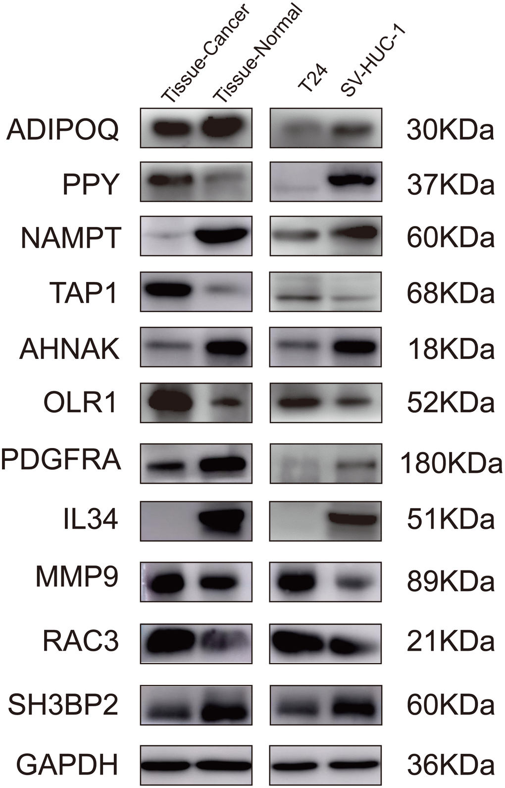 Validation of the IRGs by western blot. Validation of the IRGs by western blot on bladder cancer tissues and adjacent tissues, human normal bladder epithelial cells (SV-HUC-1), and a bladder cancer cell line (T24).