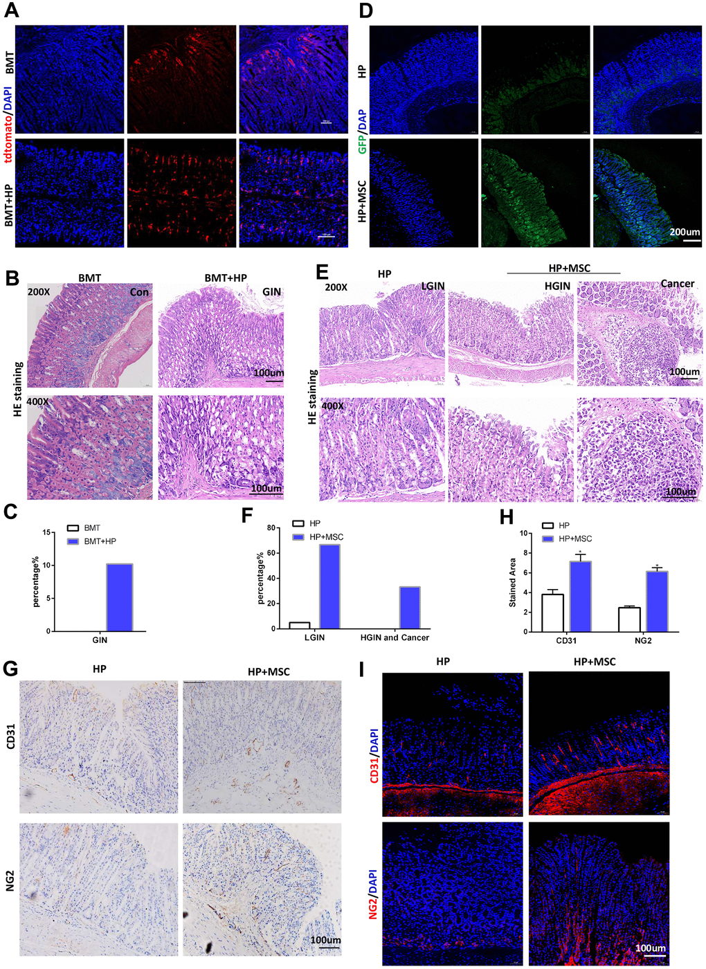 BM-MSCs promote tumorigenicity and angiogenesis in H. pylori-induced GC. (A) In BMT mice, engraftment of LSL-tdTomato marrow-derived cells in mouse gastric tissues was tracked with tdTomato staining. n= 4. (B) Representative gastric mucosa histopathology of gastric intraepithelial neoplasia (GIN) in BMT mice. (C) Quantification of GIN in B. (D) IF of GFP in H. pylori-infected stomachs transplanted with GFP-labeled BM-MSCs. (E) Representative gastric mucosa histopathology in H. pylori-infected stomachs with (H. pylori+ MSC) or without (H. pylori) BM-MSC transplantation. n= 30 mice in each group. (F) Quantification of dysplasia and GC in D. (G) IHC of CD31 and NG2 in H. pylori or H. pylori+ MSC group. (H) Quantification of F. Multiple fields (at least six) from three different mice were analyzed. (I) IF of CD31 and NG2 in H. pylori or H. pylori+ MSC group. Cell nuclei, DAPI; CD31, Cy3; NG2, Cy3. HP: H. pylori. MSC: bone marrow-derived mesenchymal stem cells. IF: immunofluorescence. The results are shown as the mean ± SD. *, P 