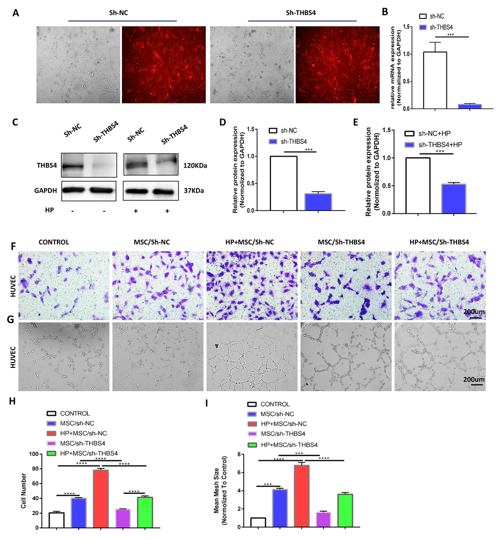 THBS4 mediates BM-MSCs to promote the migration and tube formation of HUVECs in vitro. (A) Transfection of recombinant lentiviral vectors into BM-MSCs. (B–E) qRT-PCR and Western blot analysis of THBS4 expression in BM-MSCs of both experiments transfected as indicated. n= 3 wells per group. (F, H) Transwell assays and quantification of migrated cells showed that THBS4 knockdown in BM-MSCs inhibited their ability to promote HUVEC migration. n= 3 wells in each group. (G, I) Knockdown of THBS4 in BM-MSCs alleviated its ability to promote HUVEC tube formation. n= 5 wells per group.