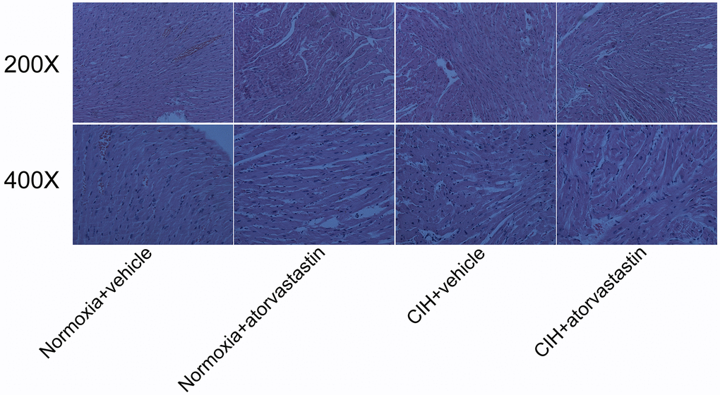 Histopathological examination of myocardial tissue. No abnormal architectural features were observed in myocardial tissue using a microscope at different magnifications in any group.