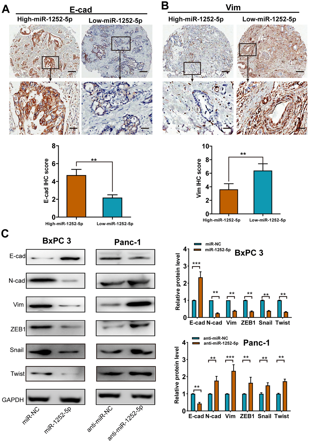MiR-1252-5p inhibited the EMT process of PAC cells. (A, B) Representative immunohistochemical staining and histograms for E-cad (A) and Vim (B) expression were showed and compared between high- and low-miR-1252-5p expressing PAC tissues. Scale bar, 200μm for upper row and 40μm for lower row. (C) Western blot analysis of EMT markers (E-cad, N-cad, Vim, ZEB1, Snail and Twist) after transfection with corresponding miRNA vectors in PAC cells. GAPDH served as a loading control. E-cad, E-cadherin; N-cad, N-cadherin; Vim, Vimentin. **P P 
