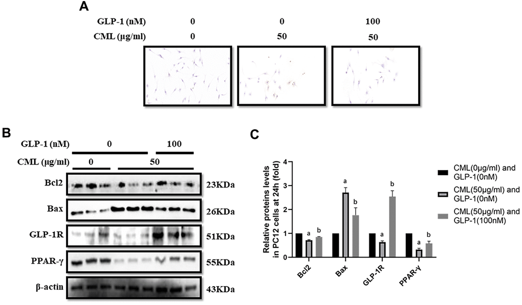 GLP-1 attenuated apoptosis of PC12 cells induced by CML. Results in (A) showed that GLP-1 restored the PC12 cells apoptosis induced by CML. (B) Showed the western blotting results of bcl2, bax, GLP-1R and PPAR-γ. “a” in (C) showed the down-regulated bcl2, PPAR-γ and GLP-1R as well as up-regulated bax in PC12 cells with 50 μg/ml CML, compared with those without CML (all P). “b” in (C) showed up-regulated bcl2, PPAR-γ and GLP-1R as well as down-regulated bax in PC12 cells with 50 μg/ml CML and 100 nM/ml GLP-1, compared with those with 50 μg/ml CML but without GLP-1 (all P). Data are represented as mean ± SD; n = 3 per group for results of western blotting.