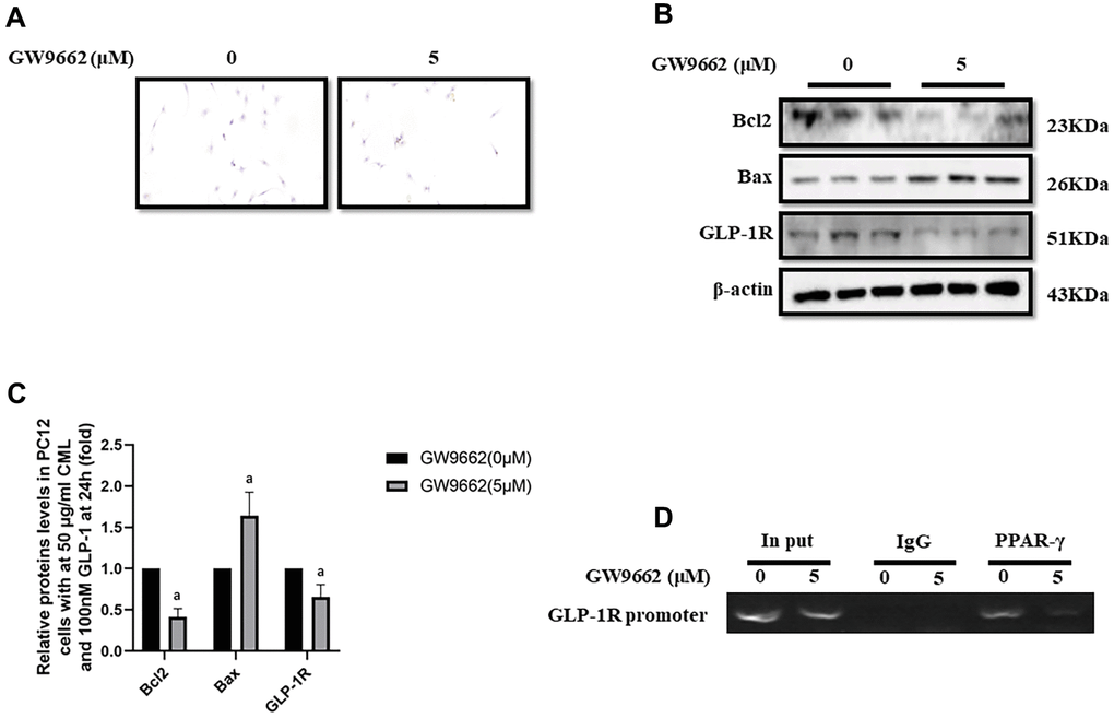 PPAR-γ inhibition abolished the protective effect of GLP-1 on PC12 cells from apoptosis induced by CML. Results in (A) showed GW9662 abolished the protective effect of GLP-1 on PC12 cells from apoptosis induced by CML. (B) Showed the western blotting results of bcl2, bax, and GLP-1R. “a” in (C) showed the down-regulated bcl2 and GLP-1R as well as up-regulated bax levels between PC12 cells (treated by 50ug/ml CML and 100 nM GLP-1) with and without 5uM GW9662. Results in (D) showed the direct interactivity between PPAR-γ and GLP-1R promoter sequence. Data are represented as mean ± SD; n = 3 per group for results of western blotting.