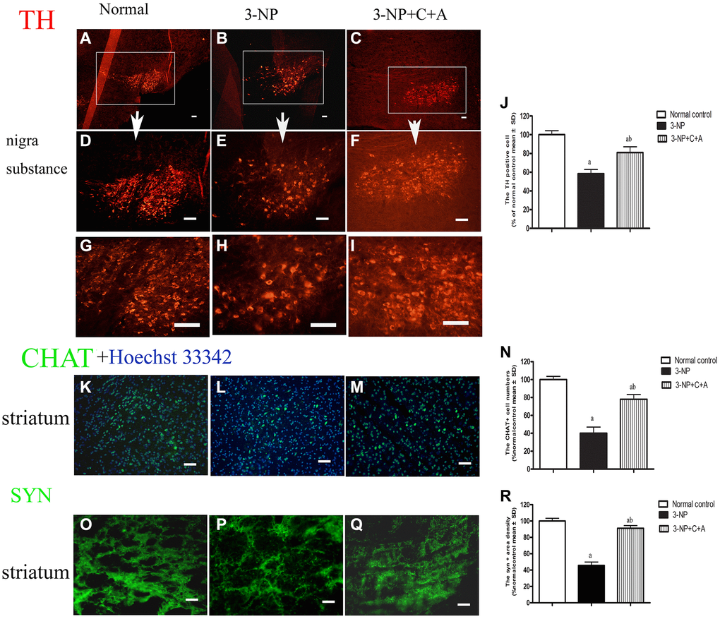 Treatment with C16+Ang-l can alleviate 3-NP-induced TH and CHAT expression decline and synaptophysin loss. Immunofluorescence images showing (A–I) TH-positive cells (red, dopaminergic neurons; white box in (A–C), nigra substance at low magnification ×40; (D–F) showed the same area at medium magnification ×100; and (G–I) at high magnification ×200), (K–M) CHAT-positive cells (green, cholinergic neurons; blue, Hoechst33342-stained cell nuclei), and (O–Q) the pixel of Syn-positive cells (synapse-associated proteins that showed synaptic plasticity and correlated with cognitive decline) in the control, 3-NP, and 3-NP+C16+Ang-1 groups. Scale bar = 100 μm. (J, N, R) semi-quantitative profiles of TH (J), CHAT (N) and Syn (R) in the control, 3-NP, and 3-NP+C16+Ang-1 groups. aP bP 