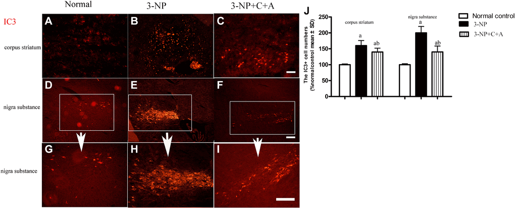 Treatment with C16+Ang-l can alleviate 3-NP-induced neuronal loss. Immunofluorescence staining in the (A–C) corpus striatum and (D–F) nigra substance (white box) at magnification ×100). (G–I) The same area of the nigra substance at ×200. (J) Semi-quantitative profiles of IC3 (an autophagy marker) in the control, 3-NP, and 3-NP+C16+Ang-1 groups. Scale bar = 100 μm. aP bP 