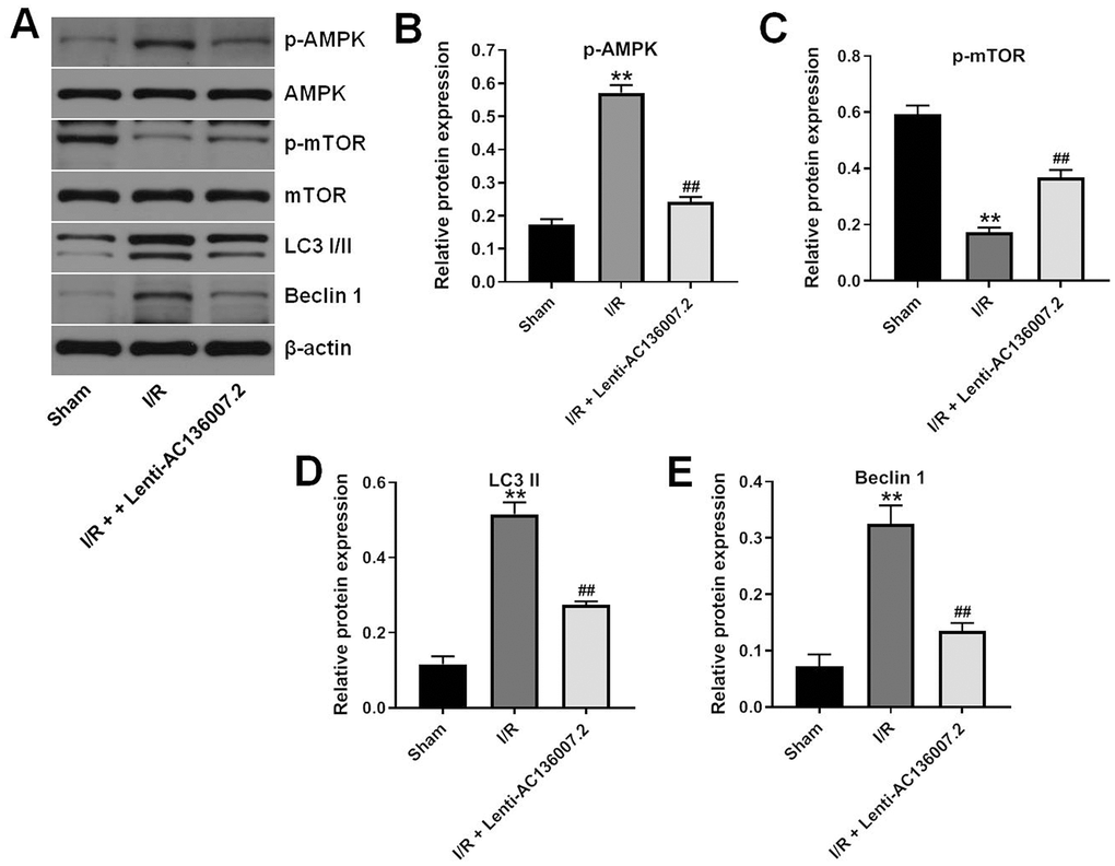 AC136007.2 inhibits IS-induced autophagy by inactivating AMPK-mTOR signaling. (A) Brain expression of LC3 I/II, Beclin 1, p-AMPK, and p-mTOR was evaluated by western blotting. (B–E) Quantification of western blotting results. Expression data were normalized to β-actin. **p## p
