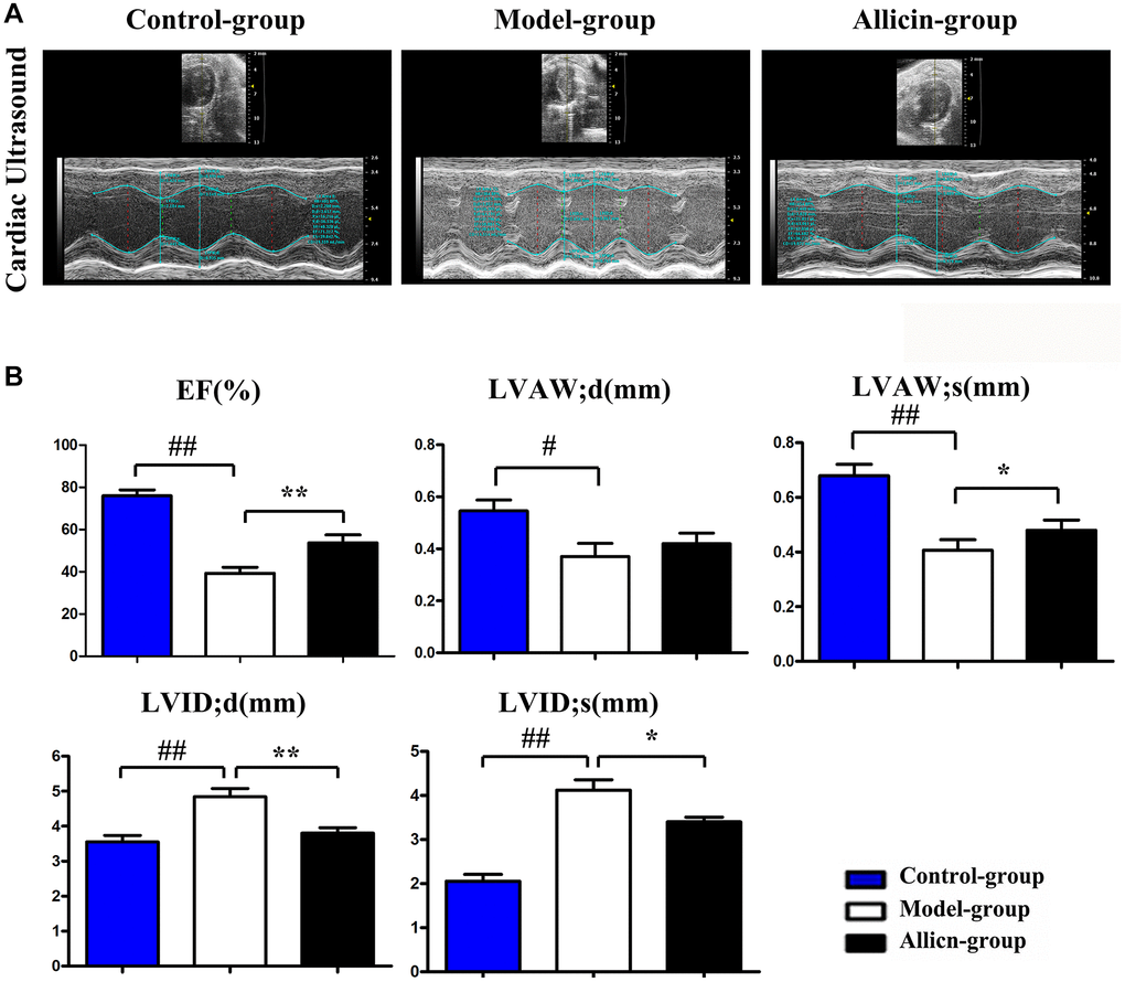 Allicin improved cardiac function in mice after myocardial IR injury. (A) Ultrasound imaging of mice in the control group, model group, and allicin group. (B) The LVEF, LVAW; d, LVAW; s LVDI; d and LVID; s of mice in each group. Data are presented as mean ± SD. **P ##P 