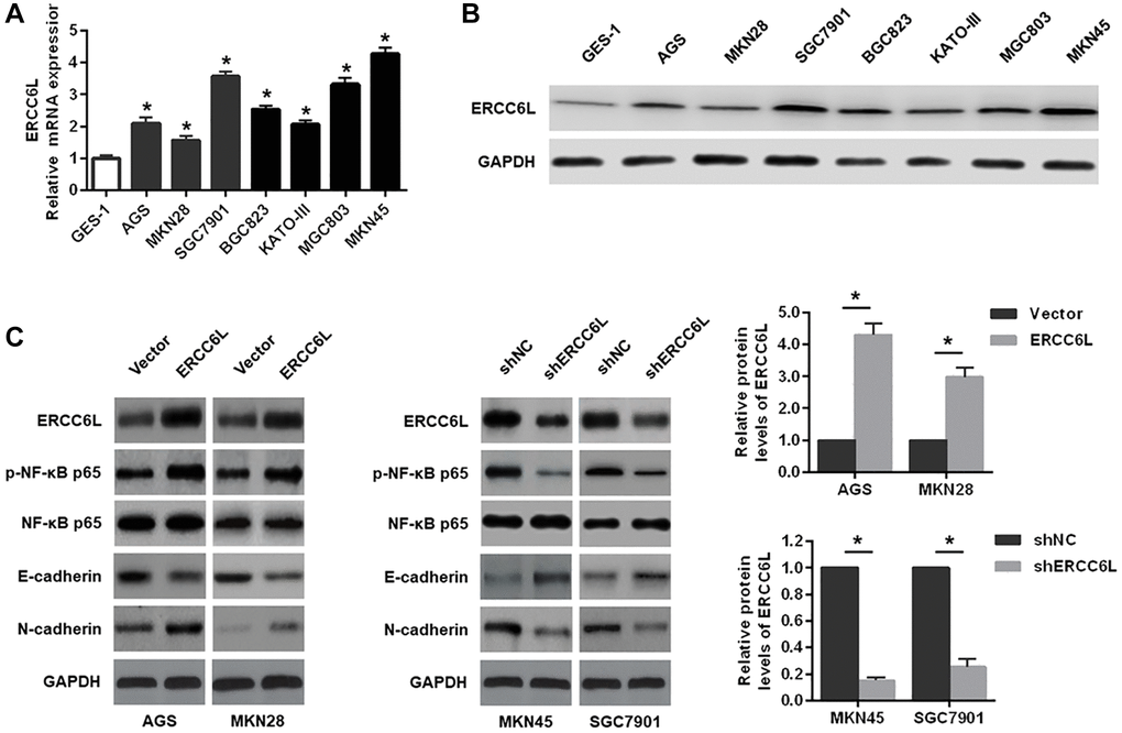 The effects of ERCC6L overexpression or knockdown on the EMT and NF-κB signaling-related markers in GC cells. (A) qRT-PCR detection of relative ERCC6L mRNA expression in human GC cell lines and a normal gastric epithelial cell line. (B) Western blot analysis of ERCC6L protein expression in human GC cell lines and a normal gastric epithelial cell line. (C) Western blot analysis of the effects of ERCC6L overexpression or knockdown on the EMT and NF-κB signaling-related markers in GC cells. *P 