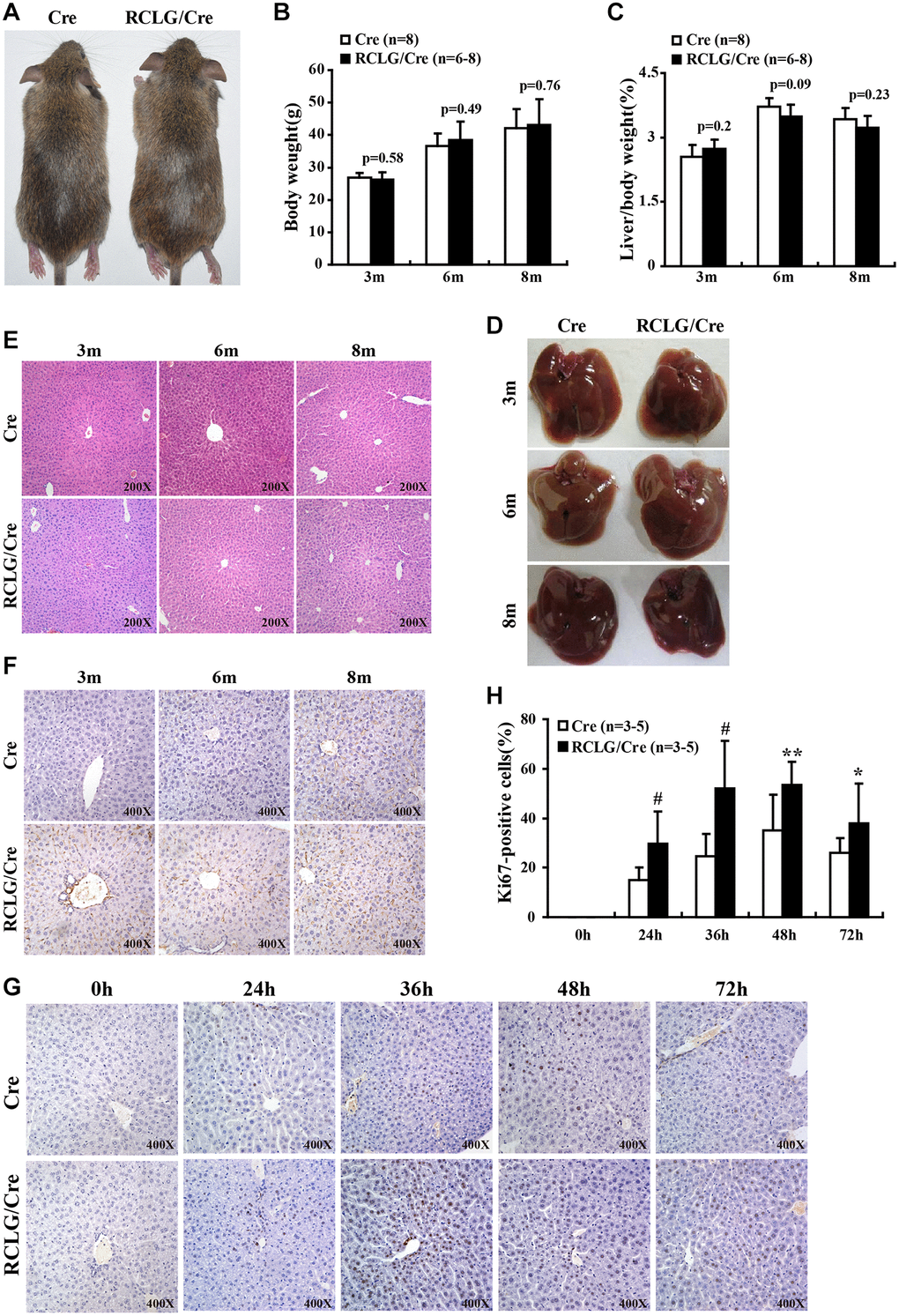 CR-1 overexpression enhances hepatocyte proliferation in the liver after 2/3 partial hepatectomy (PHx). (A) Representative images show 5-month old RCLG/Alb-Cre (right) and Alb-Cre (left) mice fed a normal diet. (B) Body weights of 3, 6, and 8 month-old RCLG/Alb-Cre and Alb-Cre mice. (C) Relative liver weights of 3, 6, and 8 month-old RCLG/Alb-Cre and Alb-Cre mice. (D) Representative images show gross morphology of livers from 3, 6, and 8 month-old RCLG/Alb-Cre (right) and Alb-Cre (left) mice. (E) Representative images of H&E-stained liver sections from 3, 6, and 8 month-old Alb-Cre and RCLG/Alb-Cre mice. (F) Representative Ki-67 immunostaining images show proliferation status of hepatocytes from 3, 6, and 8 month-old Alb-Cre and RCLG/Alb-Cre mice. (G) Representative Ki-67 immunostaining images show proliferation of hepatocytes from RCLG/Alb-Cre and Alb-Cre mice at 0, 24, 36, 48, and 72 h after PHx. (H) Quantitative analysis of hepatocyte proliferation based on Ki-67 immunostaining at 0, 24, 36, 48, and 72 h after PHx in RCLG/Alb-Cre (n = 3–5) and Alb-Cre (n = 3–5) mice.