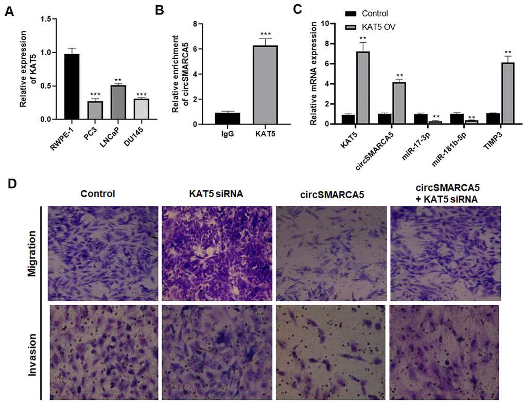 KAT5 induces circSMARCA5 production. (A) The KAT5 expression pattern in RWPE-1, DU145, LNCaP, and PC3 cells. (B) Detection of pulled-down circSMARCA5 by qRT-PCR. (C) qRT-PCR of KAT5, miR-181b-5p, TIMP3, and miR-17-3p in DU145 cells with and without KAT5 overexpression. (D) U145 cells were transfected with circSMARCA5-expressing vector and KAT5-specific siRNA, alone or in combination. Migration and invasion were determined by Transwell assays. *, **, *** represent p ≤ 0.05, p ≤ 0.01, p ≤ 0.001, respectively. Assays were performed at least three times.