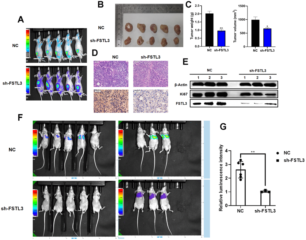 FSTL3 expression promotes gastric cancer tumorigenicity in vivo. (A) Bioimaging of MGC-803-derived tumors in the flanks of Nude mice. Growth of tumors in Nude mice injected for control MGC-803 cells (NC) or cells expressing shRNA-specific for FSTL3 (sh-FSTL3). (B) Excision and viewing of subcutaneous tumors derived from Nude mice injected for control MGC-803 cells (NC) or cells expressing shRNA-specific for FSTL3 (sh-FSTL3). (C) Analysis of weight or volume of tumors derived from Nude mice injected for control MGC-803 cells (NC) or cells expressing shRNA-specific for FSTL3 (sh-FSTL3). (D) Hematoxylin-eosin (upper panels) or Ki67 immunohistochemistry (lower panels) on tissue sections from subcutaneous tumors derived from Nude mice injected for control MGC-803 cells (NC) or cells expressing shRNA-specific for FSTL3 (sh-FSTL3). (E) Analysis of FSTL3 and Ki67 using Western blotting of tumors from Nude mice injected for control MGC-803 cells (NC) or cells expressing shRNA-specific for FSTL3 (sh-FSTL3). Blotting of tumor lysates using antibodies to FSTL3 or Ki67; antibodies to β-actin were used to check for protein loading in tumor lysates. (F) Bioluminescence imaging results of the lung metastasis frequency from Nude mice injected for control MGC-803 cells (NC) or cells expressing shRNA-specific for FSTL3 (sh-FSTL3). (G) Statistical analysis of luminescence intensity. Error bars indicate +SEM; significance indicated by asterisks, *PPP