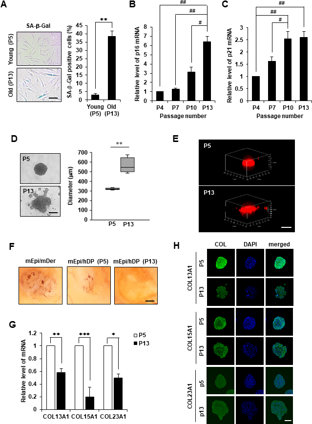 Cell aggregation, HF induction ability, and collagen expression of replicative senescent hDPCs. (A) SA-β-gal staining in young (P5) and old (P13) passage cells. Scale bar, 200 μm. Quantification for n > 200 cells per group. p16 (B) and p21 (C) mRNA expression by qRT-PCR. (D) Representative image of spheroids from young (P5) or old (p13) passage cells is shown on (top), and the size in diameter of spheroids (μm) is quantified (right). Scale bar, 200 μm. (E) 3D reconstruction of spheroids. Scale bar, 500 μm. (F) Patch assay. Senescent hDPCs (P13) failed to induce new HFs (n = 3). Scale bar, 500 μm. (G) COL13A1, COL15A1, and COL23A1 mRNA expression by qRT-PCR. (H) Immunofluorescence staining of hDPC spheroids with COL13A1, COL15A1, COL23A1, and DAPI for nuclei. Scale bar, 200 μm. All quantitative data are shown as the mean ± standard deviation (SD) of three independent experiments. *p p p #p ##p t-test. Sharp indicates one-way ANOVA.