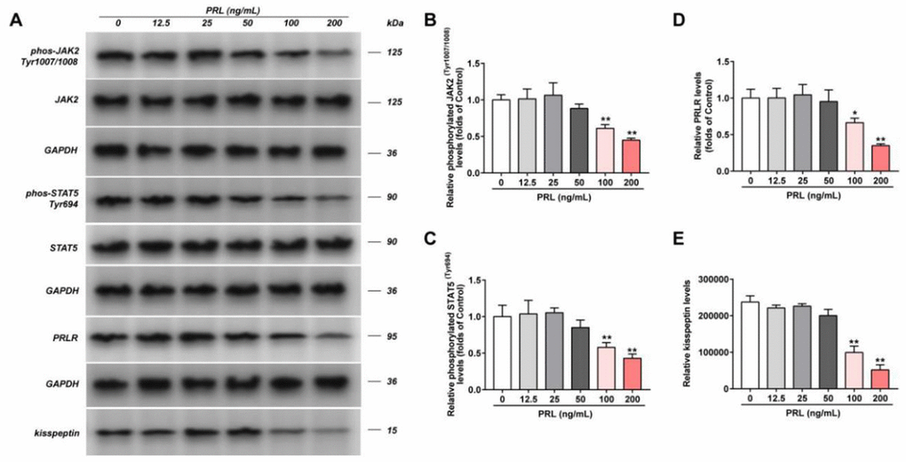 Effect of PRL on PRLR-JAK-STAT5 pathway in GT1-7. The phosphorylation levels of JAK, STAT5 and the levels of PRLR and kisspeptin in GT1-7 from different groups were detected by western blot assay, and representative bands were shown in (A). The phosphorylation levels of JAK (B) and STAT5 (C), and the level of PRLR (D), and the level of kisspeptin (E) were normalized to control. The results were presented as mean ± SD (n = 3). *p 