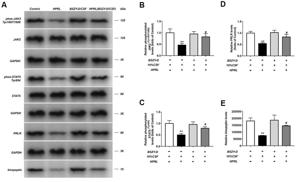 Effect of CSF on PRLR-JAK-STAT5 pathway in GT1-7. The phosphorylation levels of JAK, STAT5 and the levels of PRLR and kisspeptin in GT1-7 from different groups were detected by western blot assay, and representative bands were shown in (A). The phosphorylation levels of JAK (B) and STAT5 (C), and the level of PRLR (D), and the level of kisspeptin (E) were normalized to control. The results were presented as mean ± SD (n = 3).**p 