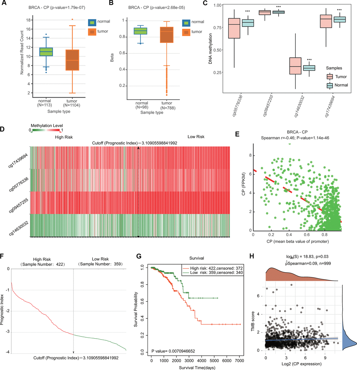 Ceruloplasmin correlates with immune infiltration and serves as a ...