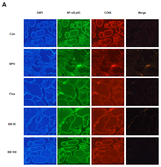 Effect of BB on expression patterns of NF-κB p65 and CD68 in testosterone-induced BPH rat model. (A) Fluorescent intensity and co-localization of NF-κB p65 and CD68+ cells in prostate sections from BPH rats. Whole-mount immunohistochemistry of the nucleus (blue), NF-κB p65 (green), and CD68 (red). The overlays show the extent of co-localization (yellow) of NF-κB p65 with macrophage marker CD68. Original magnification 100×.