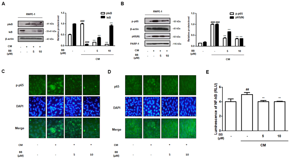 Effect of BB on NF-κB signaling pathway in CM-treated RWPE-1 cell model. (A, B) Prostatic cells stimulated with CM, with or absent 5 and 10 μM BB for 3 days. Western blot analysis of (A) pIκB, IκB and (B) p-p65, p65 in RWPE-1 cell total and nucleus lysates. ### P C, D) IF staining of (C) p-p65 and (D) p65 in CM-treated RWPE-1 cells. (E) The luciferase activity levels were determined in pNF-κB-luc reporter-transfected RWPE-1 cells.