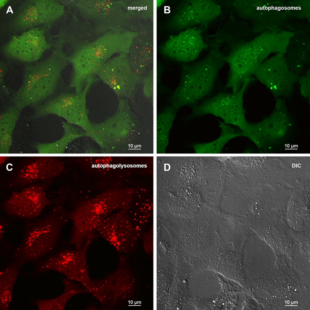 Assessment of autophagy in MRC5-SV40 carrying GFP-LC3-mCherry reporter when treated with 50 μg/ml Abisil after 24 hours. (A) merge of red, green fluorescence channels and bright field, (B) green fluorescence channel, (C) red fluorescence channel, (D) bright field.