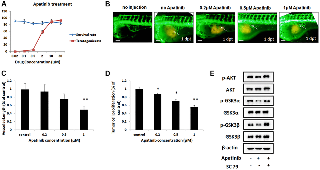 Inhibitory effect of gastric cancer cell line in the zebrafish xenograft model under apatinib treatment. (A) The survival rates and teratogenic rates of zebrafish were detected under different concentrations of apatinib. (B) Fluorescence image of subintestinal vessels in zebrafish induced by MGC-803 with/without apatinib treatment at 1 dpt. (C) Quantitative analysis of the length of newly formed vessels in zebrafish induced by MGC-803 with/without apatinib treatment. Scale bar: 50 μm. (D) Quantitative analysis of the MGC-803 cells proliferation with/without apatinib treatment at 2 dpt. Dpt: days post treatment. (E) Western blot analysis of AKT, phosphorylated AKT (p-AKT), GSK3α, phosphorylated GSK3α (p-GSK3α), GSK3β and phosphorylated GSK3β (p-GSK3β) in injected cells.