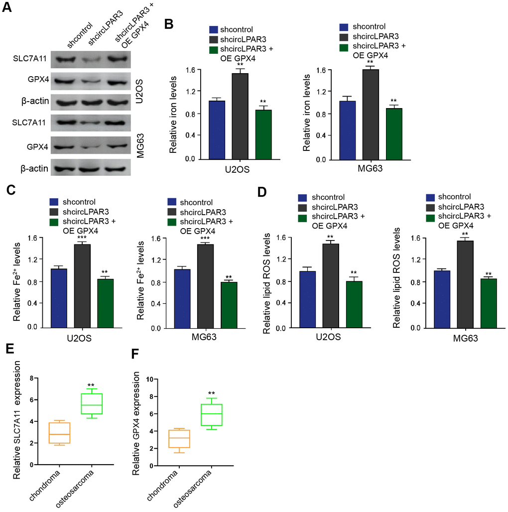 GPX4 participates in CircLPAR3-regulated ferroptosis in osteosarcoma cells. (A–D) The analysis was performed in the U2OS and MG63 cells treated with circLPAR3 shRNA and GPX4 reconstituted plasmid. (A) Western blot detected the GPX4 and SLC7A11 expression. The levels of iron (B), Fe2+ (C), and lipid ROS (D) were analyzed by the corresponding measurement kits. (E) The expression of SLC7A11 was measured in clinical osteosarcoma samples (n=50) by qPCR. (F) The expression of GPX4 was detected in clinical osteosarcoma samples (n=50) by qPCR. ** P 