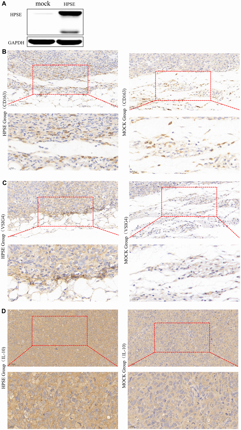 HPSE expression between MDA-MB-231-HPSE and MDA-MB-231-mock cells (A). HPSE expression correlates with IL-10 induced M2 macrophage polarization in a mouse breast tumor model: IHC staining of (B) CD163, (C) VSIG4, and (D) IL-10.