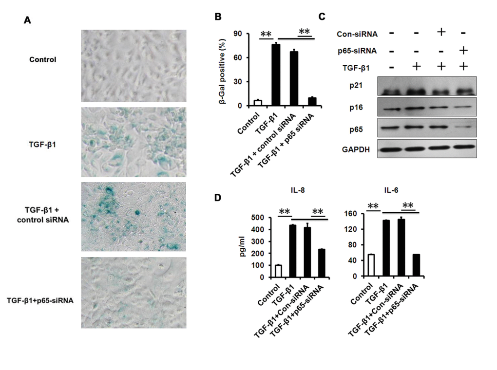 NF-κB p65-konckdown attenuates TGF-β1 induced senescence and SASP. (A-B) SA-β-Gal activity and the percentage of SA-β-gal-positive cells in HCECs treated with TGF-β1 for 3 days alone, or in combination with indicated siRNA. (C) Western blot analysis of p16 and p21 in HCECs treated with TGF-β1 for 3 days alone, or in combination with indicated siRNA. (D) The IL-6 and IL-8 in cultured HCECs supernatants were detected by ELISA. **P≤0.01. Data are representative of three independent experiments.