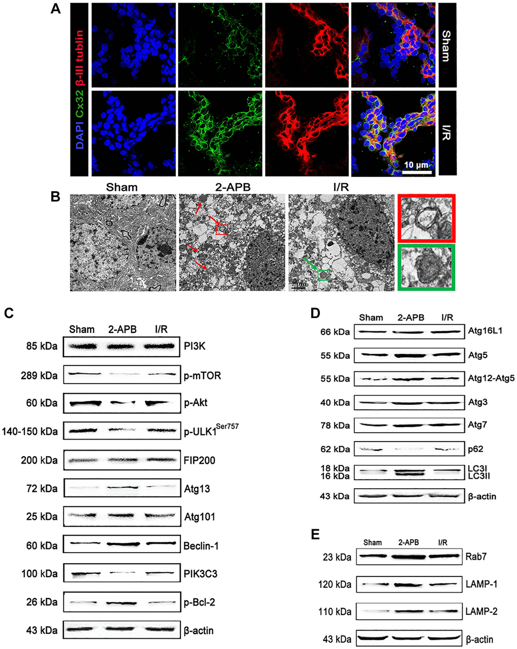 I/R induced up-regulation of Cx32 expression and activation of autophagy. (A) Double labeling of Cx32 and β-tubulin in the brains of Sham or I/R group. Scale bars, 50 μm. (B) Images acquired by transmission electron microscope. The arrow marks autophagic vacuoles. (C–E) Representative bands of autophagy-related proteins after I/R. Variation in protein loading was determined by blotting with an anti-β-actin antibody.